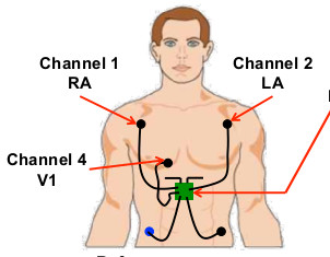 Rich Media Tags: Battery-Free Audio, Video & Health Sensing